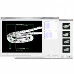 SEAMetal HD: Double Seam Inspection for Beverage Cans